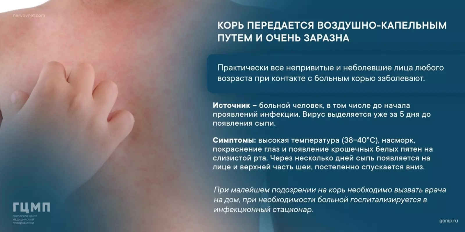О профилактике кори напомнили ГЦМП и депутат МО пос. Стрельна Павел Горбунов